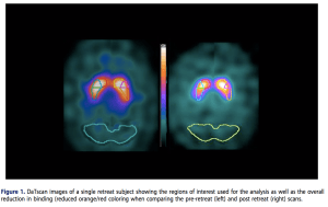 Screen Shot 2017-04-11 at 1.44.39 PM