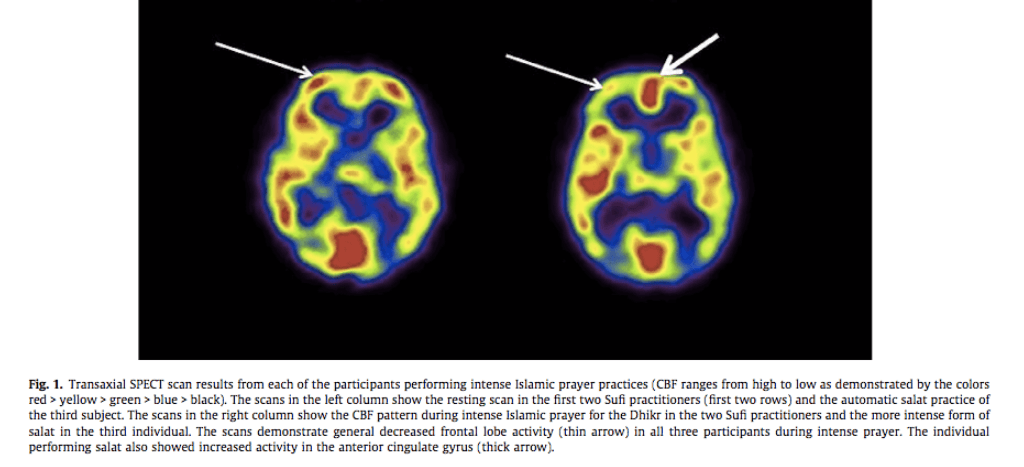 Screen Shot 2017-04-11 at 1.53.54 PM