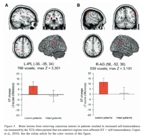 Screen Shot 2017-06-08 at 4.11.52 PM